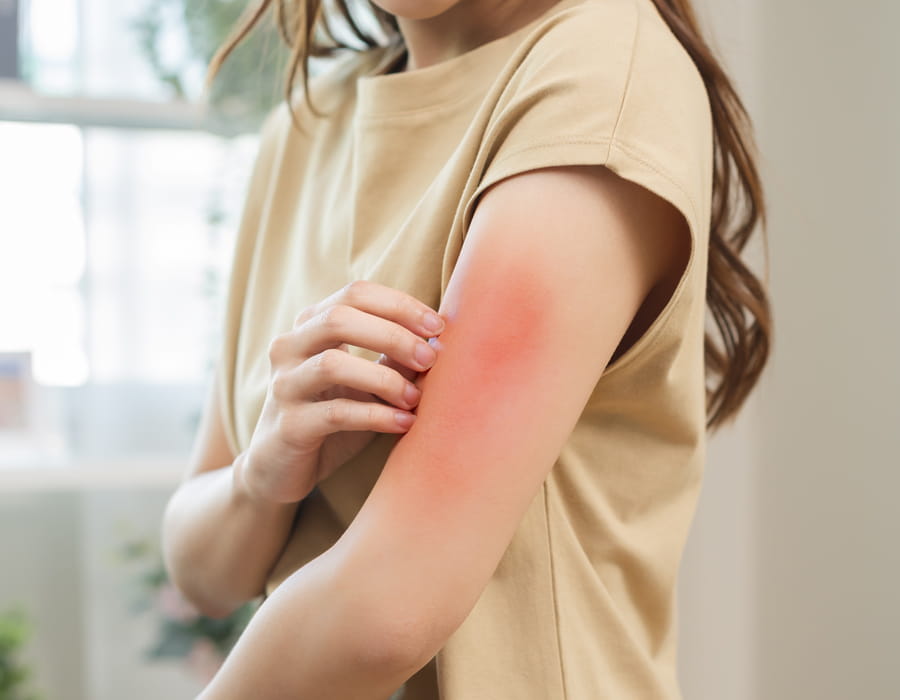 Soin esthétique pour personnes allergiques